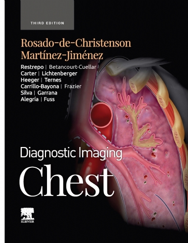 Diagnostic Imaging Chest _ Elsevier (2022)